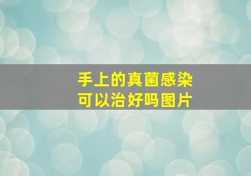 手上的真菌感染可以治好吗图片