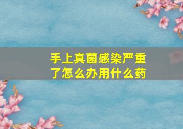 手上真菌感染严重了怎么办用什么药