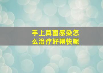 手上真菌感染怎么治疗好得快呢