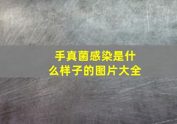 手真菌感染是什么样子的图片大全