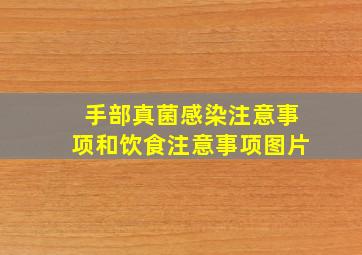 手部真菌感染注意事项和饮食注意事项图片