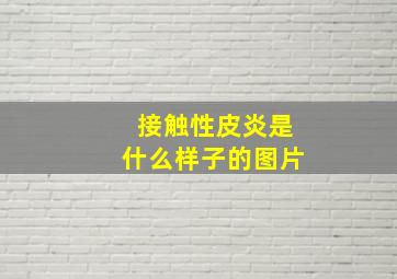 接触性皮炎是什么样子的图片