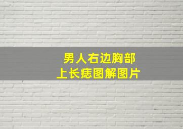 男人右边胸部上长痣图解图片