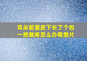 耳朵前面皮下长了个包一按就疼怎么办呢图片