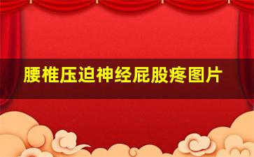 腰椎压迫神经屁股疼图片